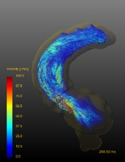 大血管の4D Flow MRI（速度マップ）
